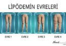 Sağlık Üzerine...Tek hapla mucize yok...